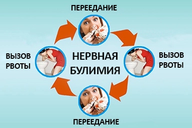 Лечение булимии в Новомышастовской
